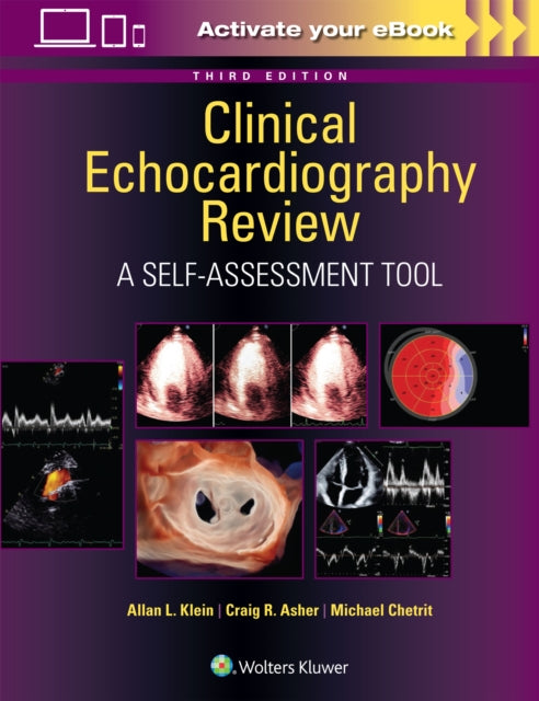 Book cover of: Clinical Echocardiography Review. By: Allan L. Klein