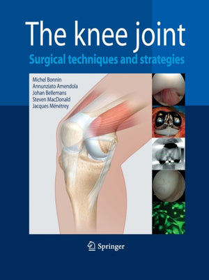 Knee Joint