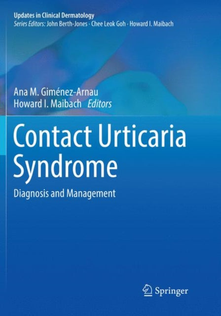 Book cover of: Contact Urticaria Syndrome