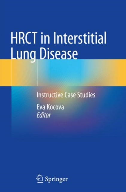 Book cover of: HRCT in Interstitial Lung Disease. By: Eva Kocova