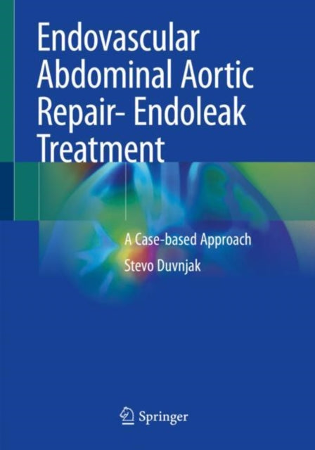 Book cover of: Endovascular Abdominal Aortic Repair- Endoleak Treatment. By: Stevo Duvnjak