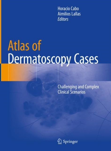 Book cover of: Atlas of Dermatoscopy Cases. By: Horacio Cabo