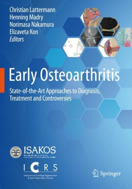 Book cover of: Early Osteoarthritis. By: Christian Lattermann