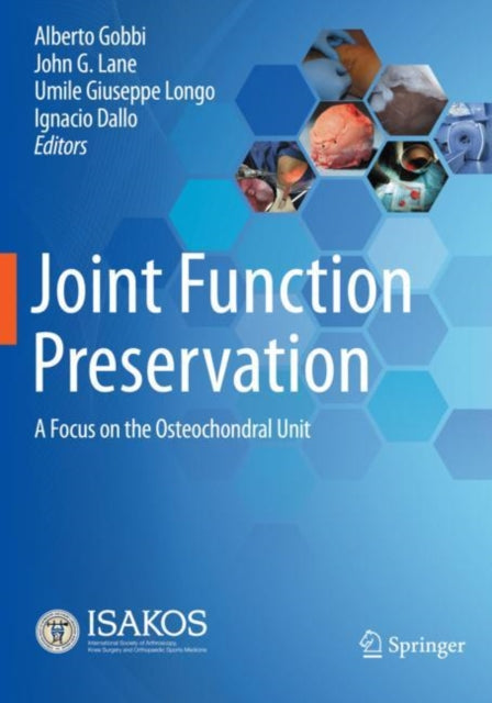 Book cover of: Joint Function Preservation. By: Alberto Gobbi