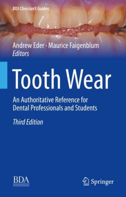 Book cover of: Tooth Wear. By: Andrew Eder