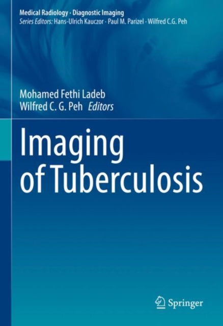 Book cover of: Imaging of Tuberculosis. By: Mohamed Fethi Ladeb