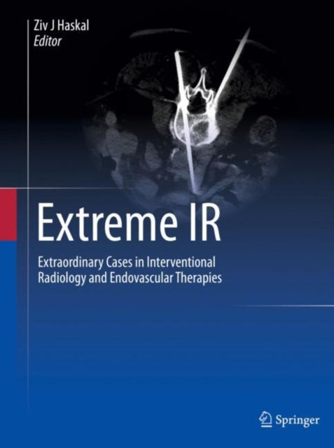 Book cover of: Extreme IR. By: Ziv J. Haskal