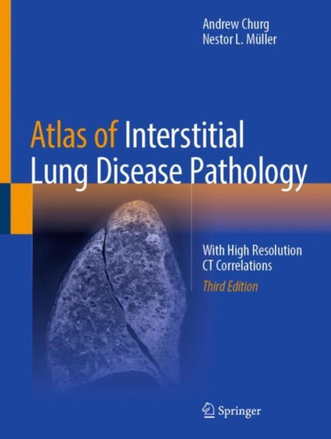Book cover of: Atlas of Interstitial Lung Disease Pathology