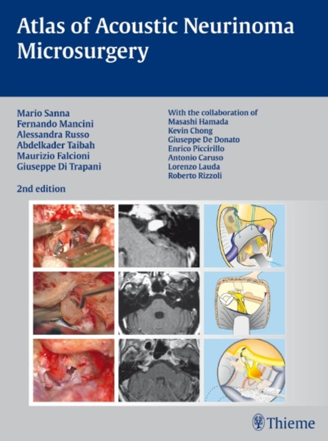 Book cover of: Atlas of Acoustic Neurinoma Microsurgery. By: M. Sanna