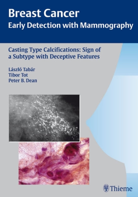 Book cover of: Casting-Type Calcifications: Sign of a Subtype with Deceptive Features. By: László Tabár, Laszlo Tabar