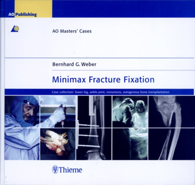 Book cover of: Minimax Fracture Fixation. By: Bernhard G. Weber