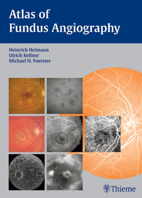 Book cover of: Atlas of Fundus Angiography. By: Heinrich, M.D. Heimann