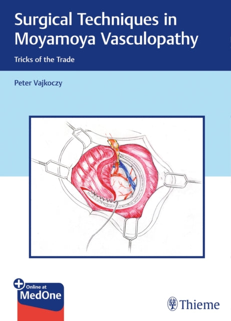 Book cover of: Surgical Techniques in Moyamoya Vasculopathy. By: Peter Vajkoczy