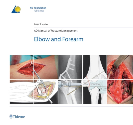 Book cover of: AO Manual of Fracture Management - Elbow & Forearm. By: Jesse B. Jupiter