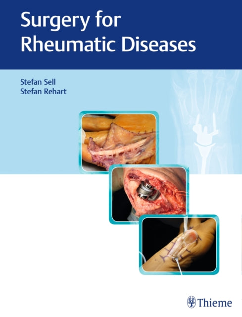 Book cover of: Surgery for Rheumatic Diseases. By: Stefan Sell