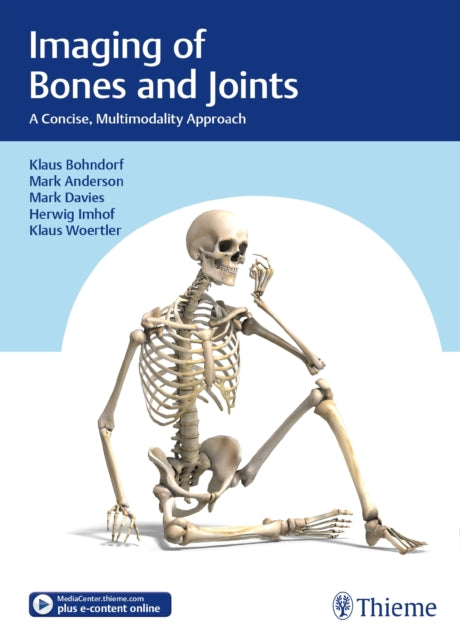 Book cover of: Imaging of Bones and Joints. By: Klaus Bohndorf