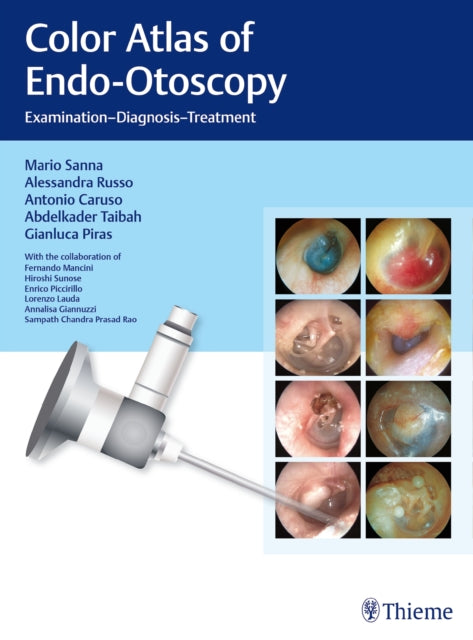 Book cover of: Color Atlas of Endo-Otoscopy. By: Mario Sanna