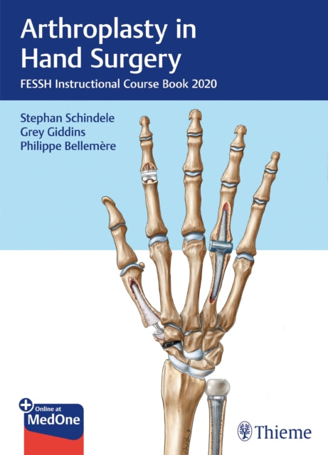 Book cover of: Arthroplasty in Hand Surgery. By: Stephan Schindele