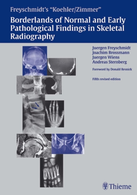 Book cover of: Freyschmidt's "Koehler/Zimmer" Borderlands of Normal and Early Pathological Findings in Skeletal Radiography. By: Jurgen Freyschmidt