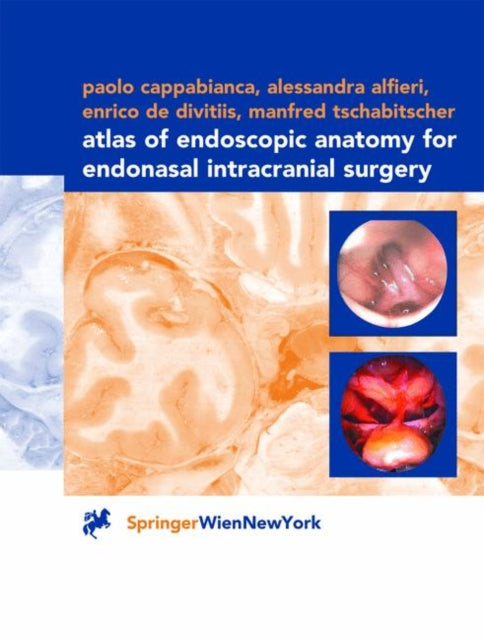 Book cover of: Atlas of Endoscopic Anatomy for Endonasal Intracranial Surgery. By: Paolo Cappabianca