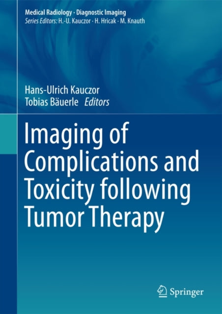 Book cover of: Imaging of Complications and Toxicity following Tumor Therapy. By: Hans-Ulrich Kauczor