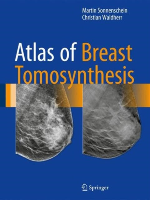 Book cover of: Atlas of Breast Tomosynthesis. By: Martin Sonnenschein