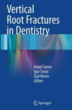 Vertical Root Fractures in Dentistry
