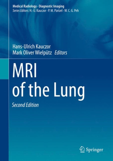 Book cover of: MRI of the Lung