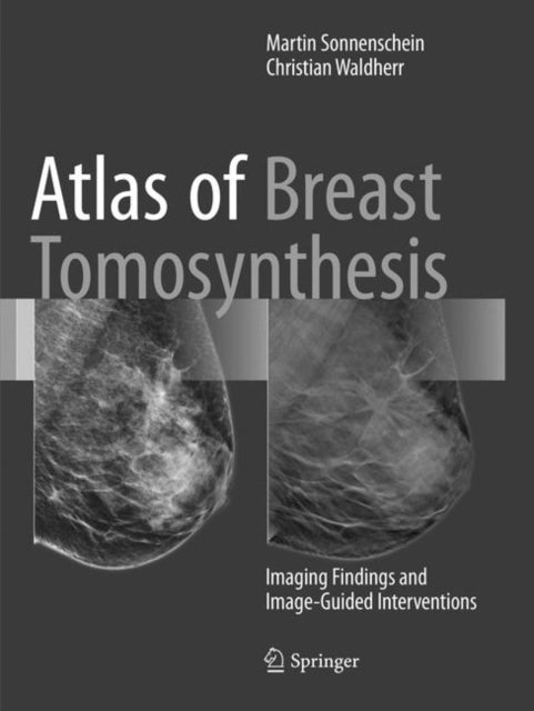 Book cover of: Atlas of Breast Tomosynthesis. By: Martin Sonnenschein