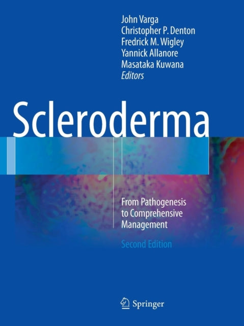 Book cover of: Scleroderma. By: John Varga