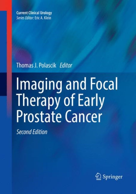 Book cover of: Imaging and Focal Therapy of Early Prostate Cancer. By: Thomas J. Polascik