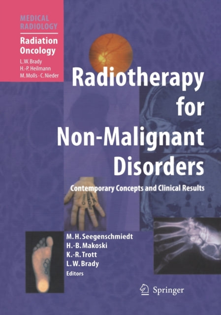Book cover of: Radiotherapy for Non-Malignant Disorders