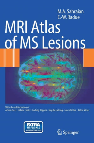 MRI Atlas of MS Lesions