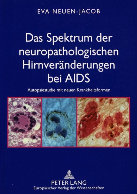 Book cover of: Das Spektrum der neuropathologischen Hirnveraenderungen bei AIDS. By: Eva Neuen-Jacob