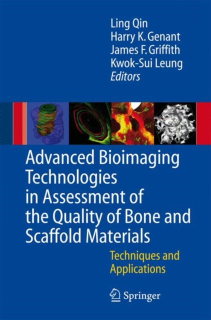 Book cover of: Advanced Bioimaging Technologies in Assessment of the Quality of Bone and Scaffold Materials. By: L. Qin
