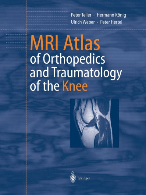 Book cover of: MRI Atlas of Orthopedics and Traumatology of the Knee. By: Peter Teller