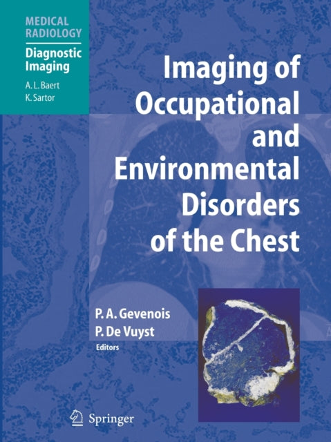 Book cover of: Imaging of Occupational and Environmental Disorders of the Chest. By: Pierre Alain Gevenois