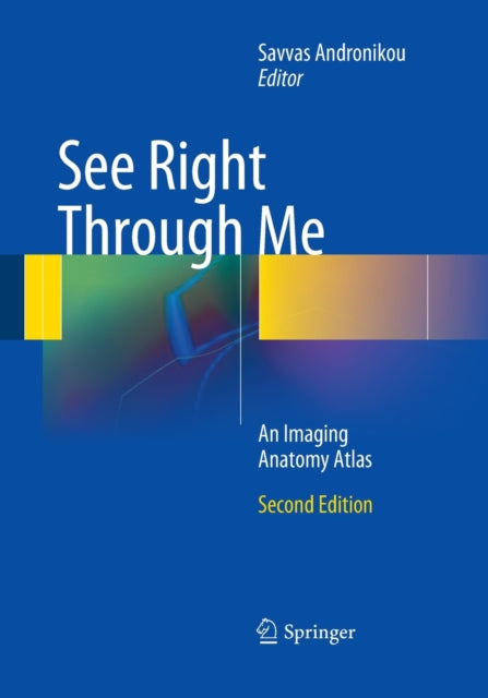 Book cover of: See Right Through Me. By: Savvas Andronikou