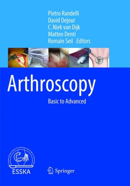 Book cover of: Arthroscopy. By: Pietro Randelli
