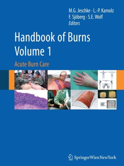 Book cover of: Handbook of Burns Volume 1. By: Marc G. Jeschke