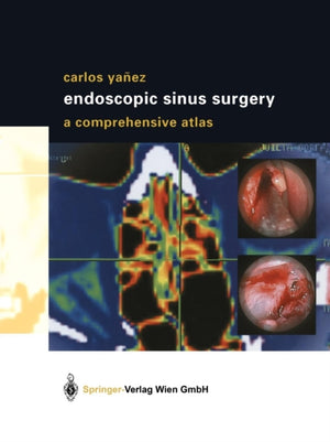 Endoscopic Sinus Surgery