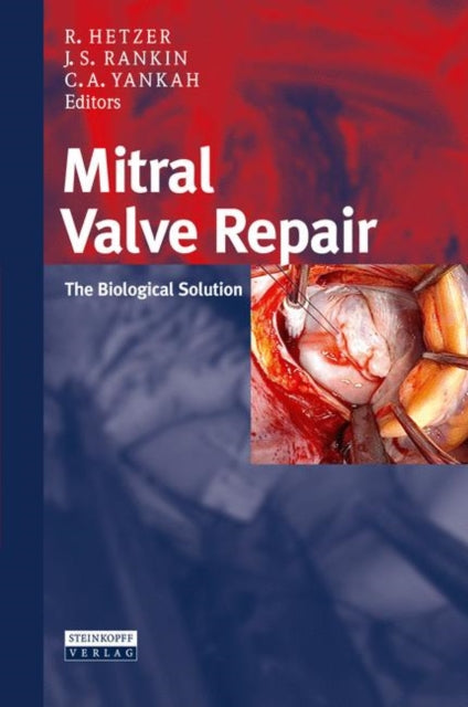 Book cover of: Mitral Valve Repair. By: Roland Hetzer