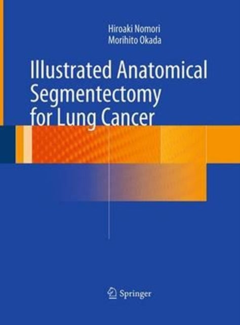 Book cover of: Illustrated Anatomical Segmentectomy for Lung Cancer. By: Hiroaki Nomori