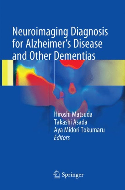 Book cover of: Neuroimaging Diagnosis for Alzheimer's Disease and Other Dementias. By: Hiroshi Matsuda