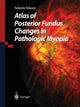 Book cover of: Atlas of Posterior Fundus Changes in Pathologic Myopia. By: Takashi Tokoro