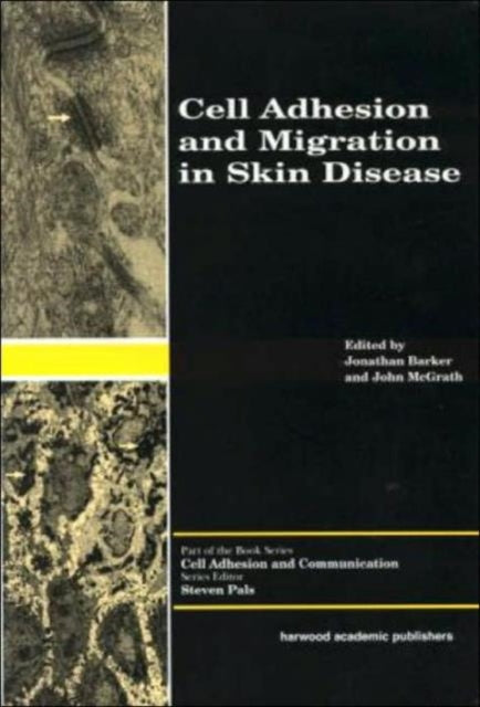 Book cover of: Cell Adhesion and Migration in Skin Disease. By: Jonathan Barker
