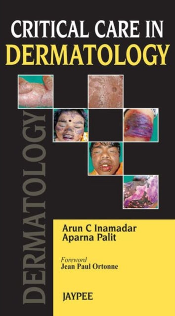 Book cover of: Critical Care in Dermatology. By: Arun C. Inamadar