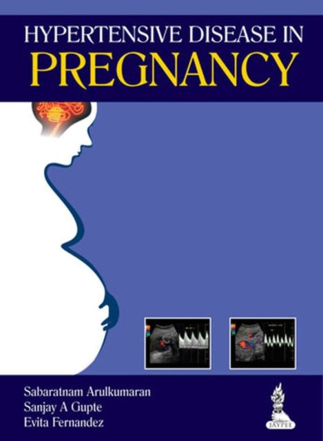 Book cover of: Hypertensive Disease in Pregnancy