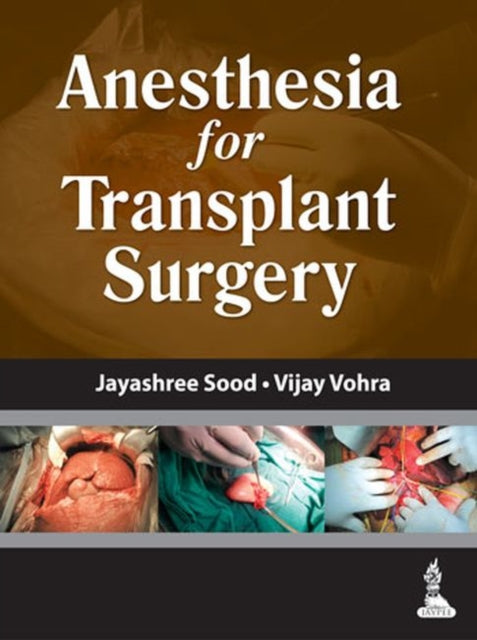 Book cover of: Anesthesia for Transplant Surgery. By: Jayashree Sood