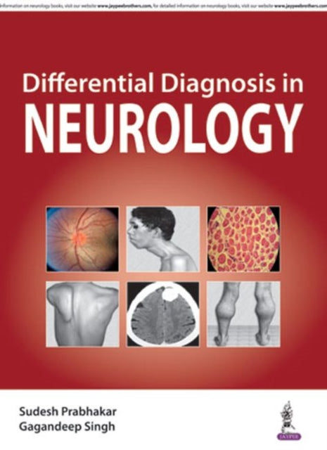 Book cover of: Differential Diagnosis in Neurology. By: Sudesh Prabhakar